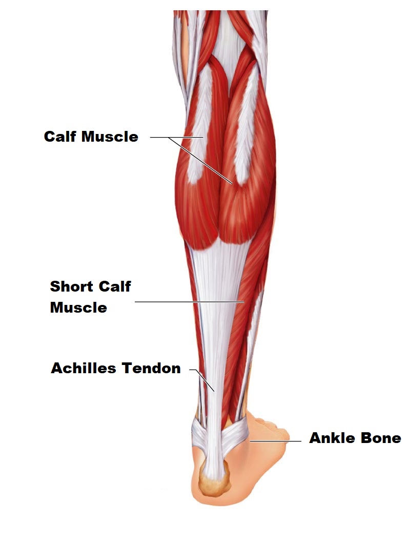 Achilles Tendinopathy? What To Do And How To Treat