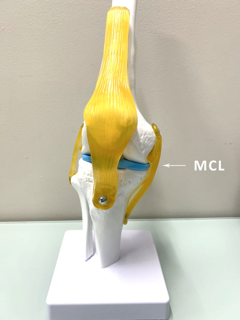 Model of the knee showing major ligaments and structures. Arrow is pointing towards the medial collateral ligament. Physio near me. Physio in mount wellington